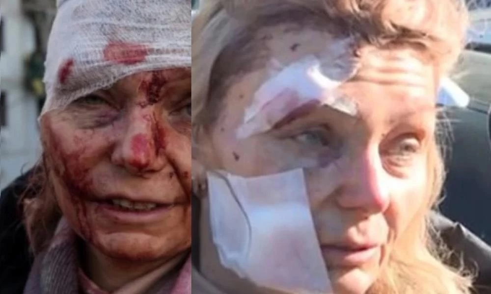 Ουκρανία: Δασκάλα γλίτωσε παρα τρίχα από πύραυλο